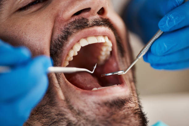 Tooth Infection Emergency Dentist in WI